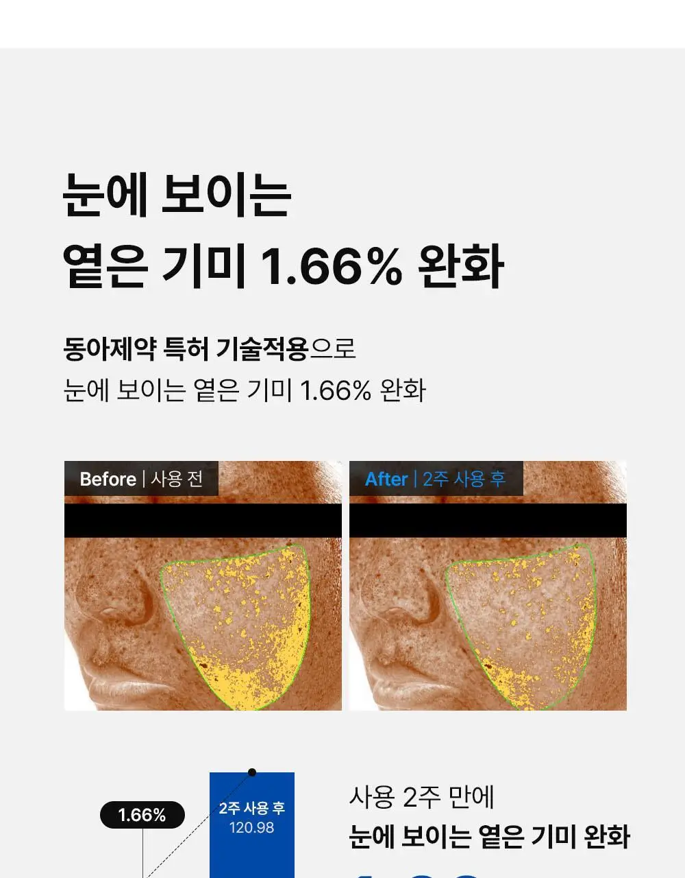 [턴오버주기개선] 동아제약 색소침착 프로 액제 30ml 상세페이지 11